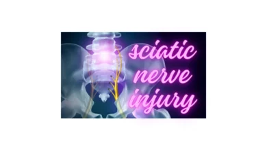 sciatic nerve injury